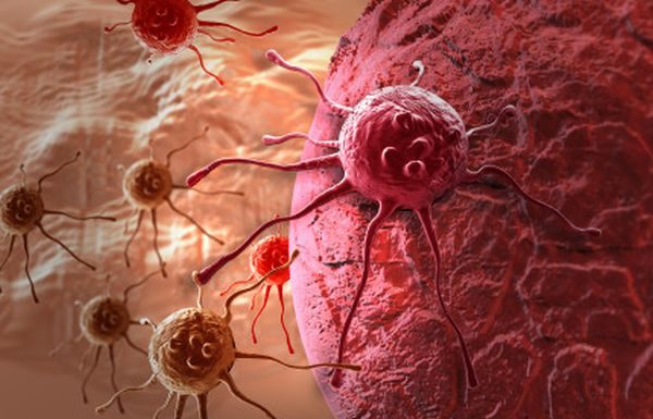 Terapia naturala pentru tratarea cancerului si a altor boli grave – Dr. Max Gerson