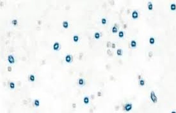 Imagini microscopice uimitoare! Priveste cum celulele canceroase sunt ucise de uleiul de cannabis!