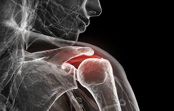 Inflamatia – Adevarata radacina a tuturor bolilor!