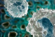 Cancerul este cauzat de infectii fungice, cum ar fi Candida!